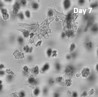 膠芽腫細胞（U-87 MG）の3D培養